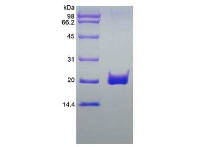 SDS-PAGE: Recombinant Human Fas/TNFRSF6/CD95 Protein [NBP2-61594]