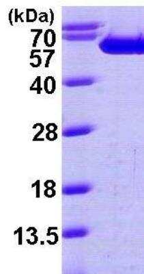 SDS-PAGE: Recombinant Human Fascin His Protein [NBP1-45313]