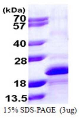 SDS-PAGE: Recombinant Human Fast skeletal myosin light chain 2 His Protein [NBP1-72343]