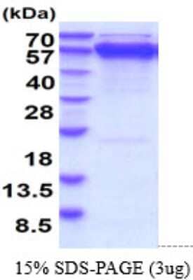 SDS-PAGE: Recombinant Mouse GRP78/HSPA5 His Protein [NBP2-61186]