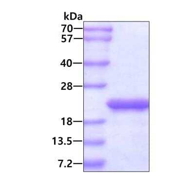 SDS-PAGE: Recombinant Human Ferritin Heavy Chain Protein [NBC1-18548]