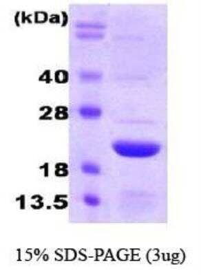 SDS-PAGE: Recombinant Human Ferritin Light Chain Protein [NBC1-18546]