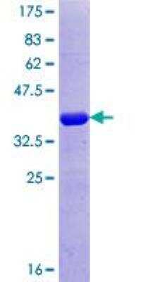 SDS-PAGE: Recombinant Human Fibrillin 2 GST (N-Term) Protein [H00002201-Q01]