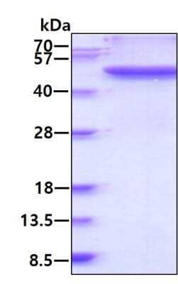 SDS-PAGE: Recombinant Human Fibrinogen gamma chain His Protein [NBP2-51960]