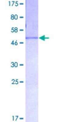 SDS-PAGE: Recombinant Human Fibrinopeptide A GST (N-Term) Protein [H00002243-P01]