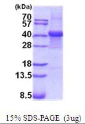 SDS-PAGE: Recombinant Human Fibrinogen beta chain His Protein [NBP2-52097]