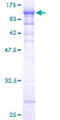 SDS-PAGE: Recombinant Human Filensin GST (N-Term) Protein [H00000631-P01]