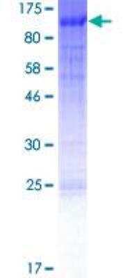 SDS-PAGE: Recombinant Human FoxN1 GST (N-Term) Protein [H00008456-P01]