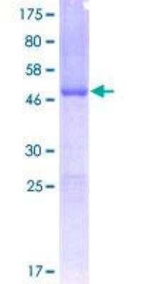 SDS-PAGE: Recombinant Human Frataxin GST (N-Term) Protein [H00002395-P01]