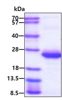 SDS-PAGE: Recombinant Human Frataxin His Protein [NBP1-30312]