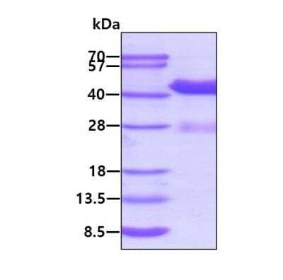 SDS-PAGE: Recombinant Human G protein alpha Inhibitor 2 His Protein [NBP2-23094]