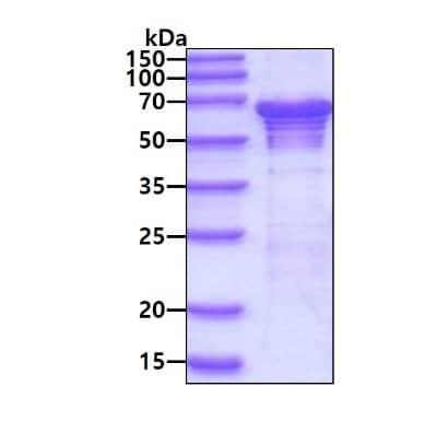 SDS-PAGE: Recombinant Human G3BP2 His Protein [NBP1-78843]