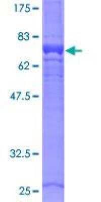 SDS-PAGE: Recombinant Human G6PC GST (N-Term) Protein [H00002538-P01]