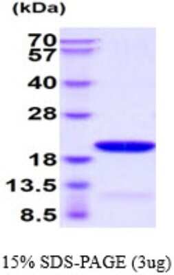 SDS-PAGE: Recombinant Human GABARAPL1 His Protein [NBP1-50916]