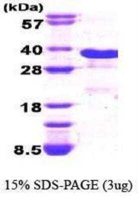 SDS-PAGE: Recombinant Human GADD153/CHOP His Protein [NBC1-18430]