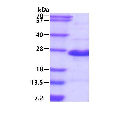 SDS-PAGE: Recombinant Human GAGE-2A His Protein [NBP2-23066]