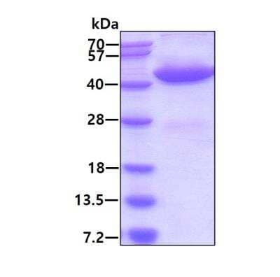 SDS-PAGE: Recombinant Human GALK1 His Protein [NBP1-45294]