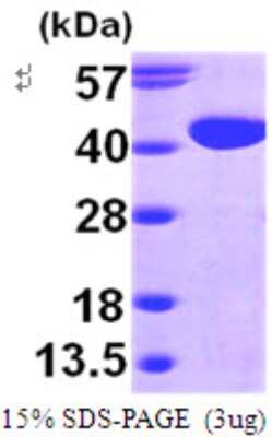 SDS-PAGE: Recombinant Human GALM His Protein [NBP1-50836]