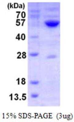 SDS-PAGE: Recombinant Human GATM His Protein [NBP1-99081]