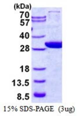 SDS-PAGE: Recombinant Human GCLM His Protein [NBP1-98869]