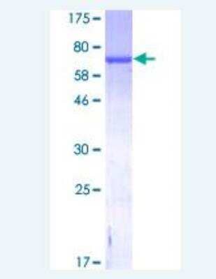 SDS-PAGE: Recombinant Human GFAP GST (N-Term) Protein [H00002670-P01]