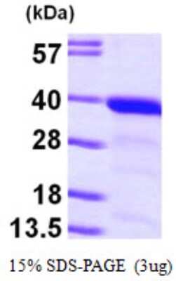 SDS-PAGE: Recombinant Human GGPS1 His Protein [NBP1-48358]