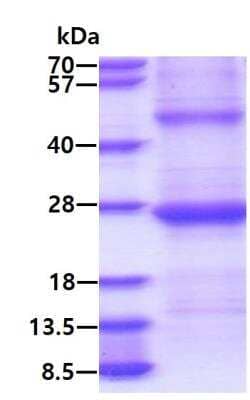 SDS-PAGE: Recombinant Human GILT/IFI30 His Protein [NBP2-23146]