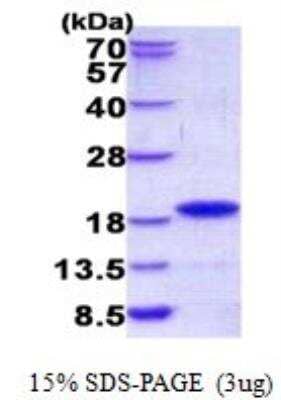 SDS-PAGE: Recombinant Human GIP His Protein [NBP2-23070]