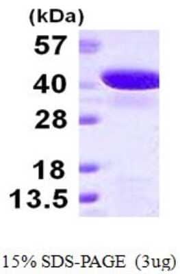 SDS-PAGE: Recombinant Human GIPC2 His Protein [NBP1-78899]