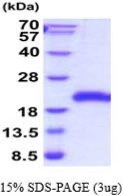 SDS-PAGE: Recombinant Human GITR/TNFRSF18 His Protein [NBP2-52215]