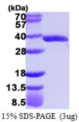 SDS-PAGE: Recombinant Human GLOD4 His Protein [NBP1-72394]