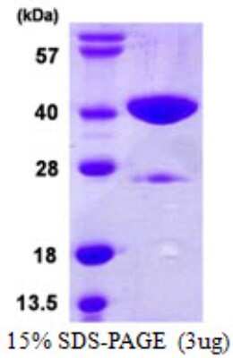 SDS-PAGE: Recombinant Human GLYAT His Protein [NBP1-72365]