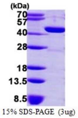 SDS-PAGE: Recombinant Human GMDS His Protein [NBP1-72521]