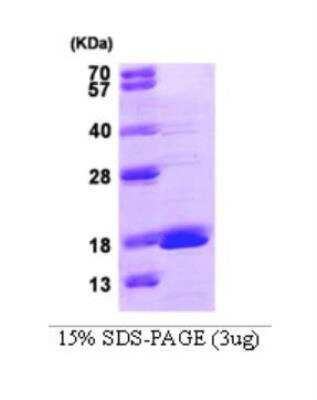 SDS-PAGE: Recombinant Human GMFG Protein [NBC1-22612]