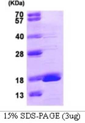 SDS-PAGE: Recombinant Human GMFG Protein [NBP1-98879]