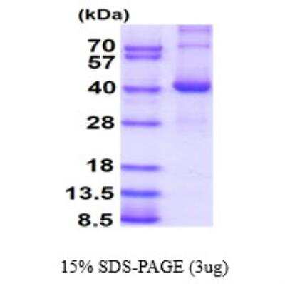 SDS-PAGE: Recombinant Human GMPR1 His Protein [NBP1-99107]