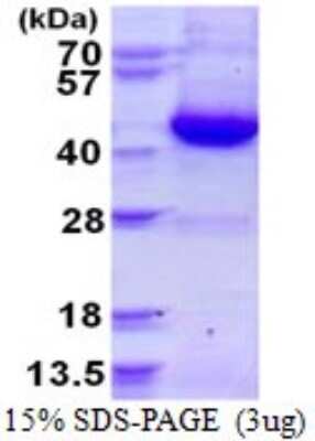 SDS-PAGE: Recombinant Human GNAI3 His Protein [NBP1-99039]