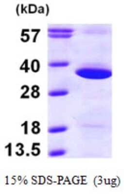 SDS-PAGE: Recombinant Human GNPDA1 His Protein [NBP1-48357]