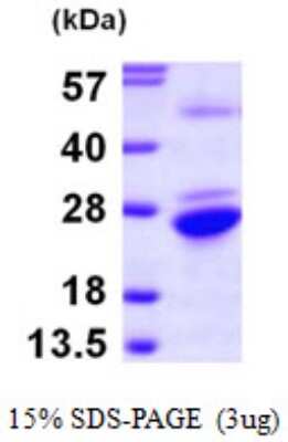 SDS-PAGE: Recombinant Human GNPNAT1 His Protein [NBP1-50901]