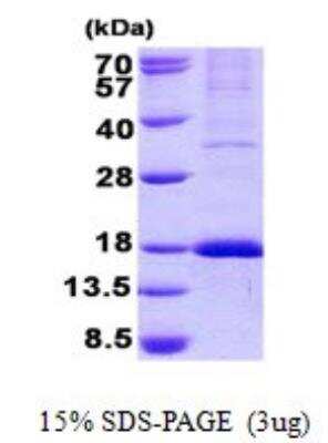 SDS-PAGE: Recombinant Human GPR177/WLS His Protein [NBP2-22947]