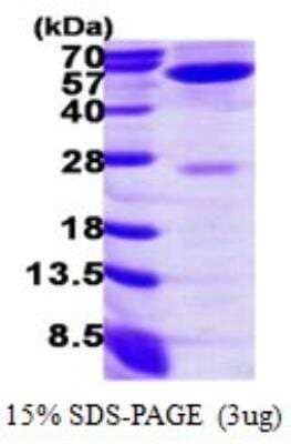 SDS-PAGE: Recombinant Human GPT His Protein [NBP1-72522]