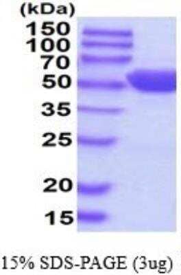 SDS-PAGE: Recombinant Human GPT His Protein [NBP2-52178]