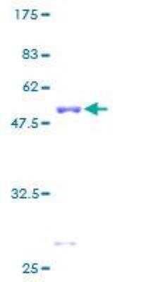 SDS-PAGE: Recombinant Human GRB2 GST (N-Term) Protein [H00002885-P01]
