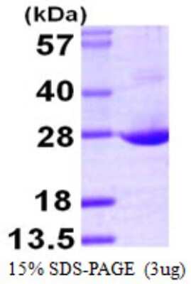 SDS-PAGE: Recombinant Human GRG (Groucho homolog) His Protein [NBP1-51027]