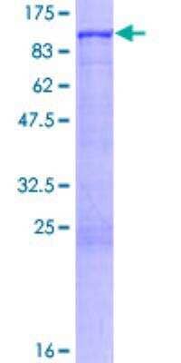 SDS-PAGE: Recombinant Human GRK2 GST (N-Term) Protein [H00000156-P01]