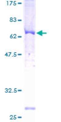 SDS-PAGE: Recombinant Human GRK3 GST (N-Term) Protein [H00000157-P01]