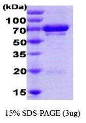 SDS-PAGE: Recombinant Human GRP75/HSPA9B/Mortalin His Protein [NBC1-18380]