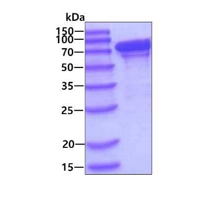 SDS-PAGE: Recombinant Human GRP78/HSPA5 His Protein [NBC1-18378]