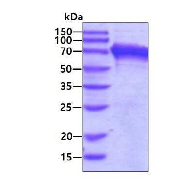 SDS-PAGE: Recombinant Human GRP78/HSPA5 His Protein [NBP2-23104]