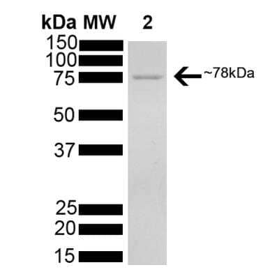 SDS-PAGE: Recombinant Human GRP78/HSPA5 His Protein [NBP3-18319]